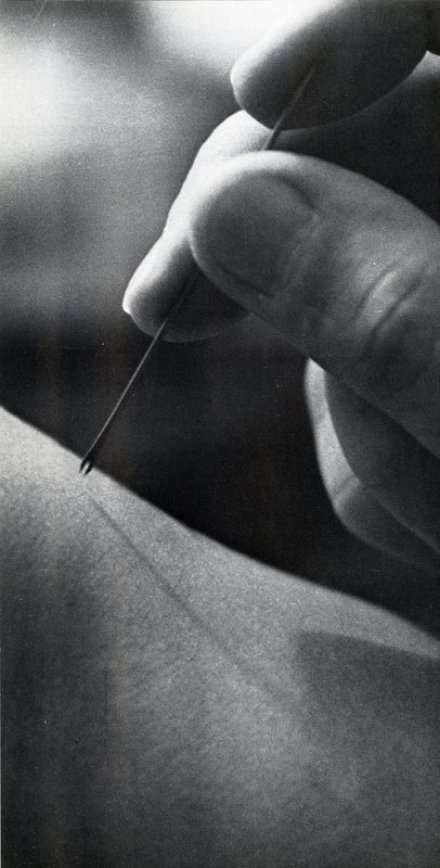 Bifurcated needle